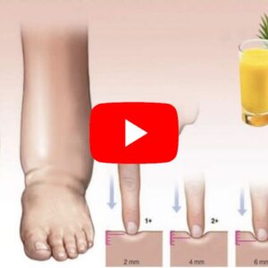 Lymph Relief